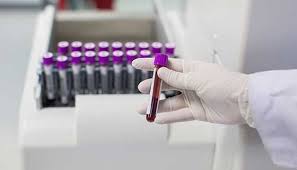 Hematology Lab Testing Services