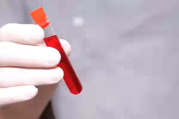 Hepatitis Profile, Comprehensive by CLIA Serum Test